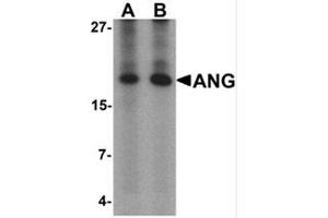 Western blot analysis of ANG in rat liver tissue lysate with Ang Antibody  at (A) 1 and (B) 2 μg/mL. (ANG Antikörper  (Middle Region))