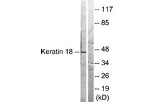 Western blot analysis of extracts from HeLa cells, treated with UV 5', using Keratin 18 (Ab-33) Antibody. (Cytokeratin 18 Antikörper  (AA 1-50))