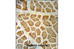PSA Antibody IHC analysis in formalin fixed and paraffin embedded human Skeletal muscle followed by peroxidase conjugation of the secondary antibody and DAB staining. (Prostate Specific Antigen Antikörper  (C-Term))