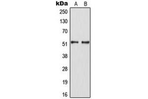 Western blot analysis of HNF4 alpha (pS313) expression in SW480 (A), HepG2 EGF-treated (B) whole cell lysates. (HNF4A Antikörper  (pSer313))