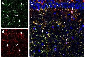Multiplex staining of CX3CR1 and CD11b in rat hippocampus. (CX3CR1 Antikörper  (Extracellular))
