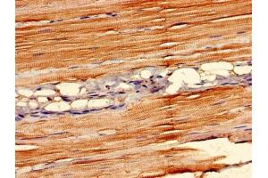 Immunohistochemistry (IHC) image for anti-Family with Sequence Similarity 168, Member B (FAM168B) (AA 43-100) antibody (ABIN7160449)