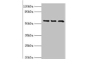 Western blot All lanes: F-box-like/WD repeat-containing protein TBL1XR1 antibody at 10 μg/mL Lane 1: MCF-7 whole cell lysate Lane 2: Mouse heart tissue Lane 3: K562 whole cell lysate Secondary Goat polyclonal to rabbit IgG at 1/10000 dilution Predicted band size: 56 kDa Observed band size: 56 kDa (TBL1XR1 Antikörper  (AA 1-180))