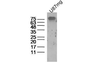 Human U87mg cells probed with beta amyloid 1-16 Polyclonal Antibody, unconjugated  at 1:300 overnight at 4°C followed by a conjugated secondary antibody at 1:10000 for 90 minutes at 37°C. (beta Amyloid 1-16 (AA 1-16) Antikörper)