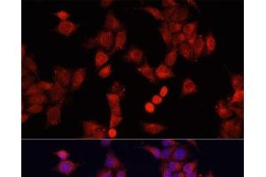 Immunofluorescence analysis of HeLa cells using SMAD2 Polyclonal Antibody at dilution of 1:100. (SMAD2 Antikörper)