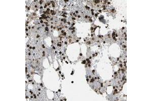 Immunohistochemical staining of human bone marrow with CACHD1 polyclonal antibody  shows strong cytoplasmic positivity in subsets of bone marrow poietic cells at 1:1000-1:2500 dilution.