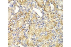 Immunohistochemistry of paraffin-embedded Rat kidney using PPP2R2A Polyclonal Antibody at dilution of 1:100 (40x lens). (PPP2R2A Antikörper)