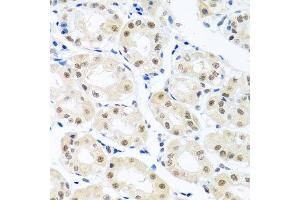 Immunohistochemistry (Paraffin-embedded Sections) (IHC (p)) image for anti-THO Complex 1 (THOC1) (AA 428-657) antibody (ABIN6149115)