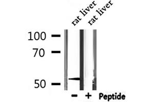 Western blot analysis of extracts from mouse liver, using MeCP2 antibody. (MECP2 Antikörper  (N-Term))