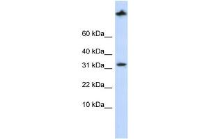 WB Suggested Anti-SCP2 Antibody Titration: 0. (SCP2 Antikörper  (Middle Region))