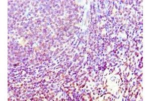 Immunohistochemistry (IHC) image for anti-Unc-51 Like Kinase 1 (ULK1) (AA 1-220) antibody (ABIN7174562)