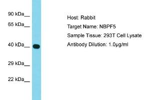 Host: Rabbit Target Name: NBPF5 Sample Type: 293T Whole Cell lysates Antibody Dilution: 1. (NBPF5 Antikörper  (Middle Region))