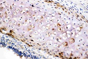Anti-Collagen II antibody, IHC(F): Rat Trachea Tissue (COL2A1 Antikörper  (C-Term))
