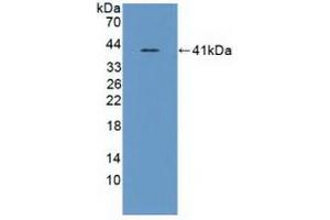 Detection of Recombinant ASNS, Human using Polyclonal Antibody to Asparagine Synthetase (ASNS) (Asparagine Synthetase Antikörper  (AA 213-536))
