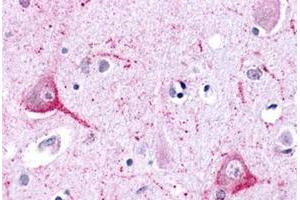 Immunohistochemical staining of human brain, neurons and glia with LPHN2 polyclonal antibody . (LPHN2 Antikörper  (N-Term))
