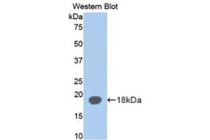 Western Blotting (WB) image for anti-alpha-2-Glycoprotein 1, Zinc-Binding (AZGP1) antibody (Biotin) (ABIN1171671) (AZGP1 Antikörper  (Biotin))
