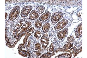 IHC-P Image Citrate synthetase antibody [N2C3] detects Citrate synthetase protein at mitochondria on mouse intestine by immunohistochemical analysis. (CS Antikörper)