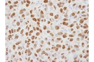 Immunohistochemistry (IHC) image for anti-Histone Deacetylase 1 (HDAC1) (C-Term) antibody (ABIN7448972) (HDAC1 Antikörper  (C-Term))