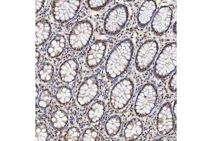 IHC analysis of U1A/SNRPA using anti-U1A/SNRPA antibody (ABIN7600891). (SNRPA1 Antikörper  (AA 25-218))