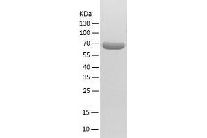 Western Blotting (WB) image for Acyl-CoA Dehydrogenase, Very Long Chain (ACADVL) (AA 41-655) protein (His tag) (ABIN7121680)