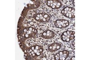 Immunohistochemical staining of human rectum with DSCR3 polyclonal antibody  shows strong cytoplasmic positivity in granular pattern in glandular cells. (DSCR3 Antikörper)