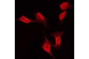 ABIN6275403 staining Hela by IF/ICC. (FAM35A Antikörper  (Internal Region))
