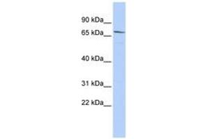 Image no. 1 for anti-Maternal Embryonic Leucine Zipper Kinase (MELK) (AA 432-481) antibody (ABIN6743416) (MELK Antikörper  (AA 432-481))
