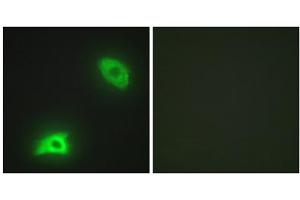 Immunofluorescence analysis of HeLa cells, using DUSP6 antibody.