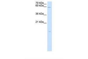 Image no. 2 for anti-Retinoic Acid Receptor Responder (Tazarotene Induced) 3 (RARRES3) (AA 51-100) antibody (ABIN321114) (RARRES3 Antikörper  (AA 51-100))