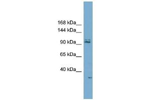 WB Suggested Anti-RC3H2 Antibody Titration:  0. (RC3H2 Antikörper  (Middle Region))