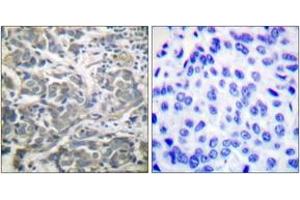 Immunohistochemistry (IHC) image for anti-SNF1A/AMP-Activated Protein Kinase (SNF1A) (AA 140-189) antibody (ABIN2888561) (AMPK alpha Antikörper  (AA 140-189))
