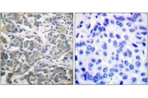 Immunohistochemistry (IHC) image for anti-SNF1A/AMP-Activated Protein Kinase (SNF1A) (AA 140-189) antibody (ABIN2888561) (AMPK alpha Antikörper  (AA 140-189))