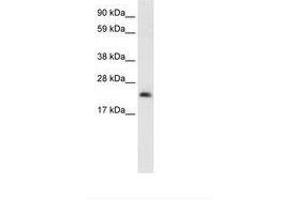 Image no. 1 for anti-High Mobility Group Box 3 (HMGB3) (N-Term) antibody (ABIN202056) (HMGB3 Antikörper  (N-Term))