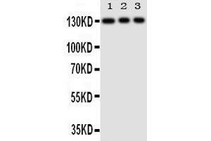 Anti-TLR10 antibody, Western blotting Lane 1: HELA Cell Lysate Lane 2: JURKAT Cell Lysate Lane 3: CEMJ Cell Lysate (TLR10 Antikörper  (N-Term))