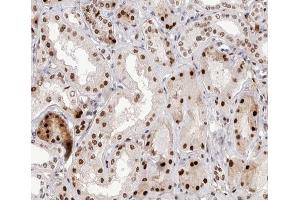 ABIN6267582 at 1/200 staining human kidney tissue sections by IHC-P. (NFKB2 Antikörper  (pSer866))