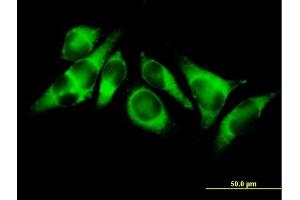 Immunofluorescence of purified MaxPab antibody to ACSL3 on HeLa cell. (Acsl3 Antikörper  (AA 1-720))