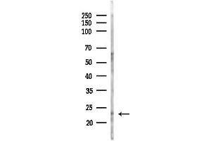 anti-RAB43, Member RAS Oncogene Family (RAB43) (Internal Region) antibody