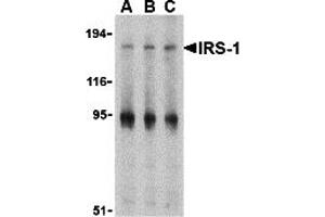 Western Blotting (WB) image for anti-Insulin Receptor Substrate 1 (IRS1) (Middle Region) antibody (ABIN1030966) (IRS1 Antikörper  (Middle Region))