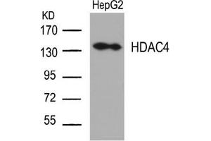 Image no. 2 for anti-Histone Deacetylase 4 (HDAC4) (Ser632) antibody (ABIN197339) (HDAC4 Antikörper  (Ser632))