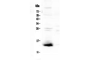 Western blot analysis of TFF2 using anti-TFF2 antibody .