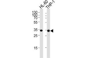 Western Blotting (WB) image for anti-Malate Dehydrogenase 1, NAD (Soluble) (MDH1) antibody (ABIN3001705) (MDH1 Antikörper)