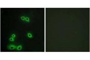 Immunofluorescence analysis of A549 cells, using MUC1 Antibody. (MUC1 Antikörper  (AA 1191-1240))