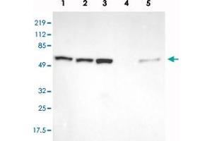 Western blot analysis of Lane 1: RT-4, Lane 2: U-251 MG, Lane 3: A-431, Lane 4: Liver, Lane 5: Tonsil with GPKOW polyclonal antibody  at 1:250-1:500 dilution.