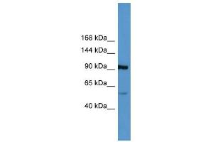 Lp (a) antibody (70R-10023) used at 0. (LPA Antikörper  (Middle Region))