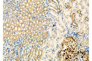 ABIN6265799 and ABIN6266785 at 1/100 staining Mouse kidney tissue by IHC-P. (TUBGCP3 Antikörper  (N-Term))