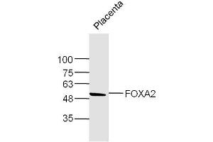 Mouse Placenta lysates probed with FOXA2 Polyclonal Antibody, Unconjugated  at 1:300 dilution and 4˚C overnight incubation.