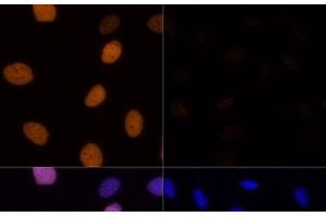 Immunofluorescence (IF) image for anti-Histone H4 (acLys16) antibody (ABIN7261235)