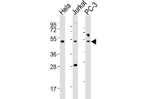 All lanes : Anti-NFKBIE Antibody (Center) at 1:2000 dilution Lane 1: Hela whole cell lysates Lane 2: Jurkat whole cell lysates Lane 3: PC-3 whole cell lysates Lysates/proteins at 20 μg per lane. (NFKBIE Antikörper  (AA 191-224))