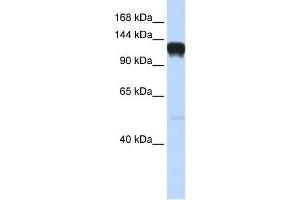 Eph Receptor A5 antibody used at 1 ug/ml to detect target protein.