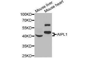 Western blot analysis of extracts of various cell lines, using AIPL1 antibody (ABIN5973857) at 1/1000 dilution. (AIPL1 Antikörper)